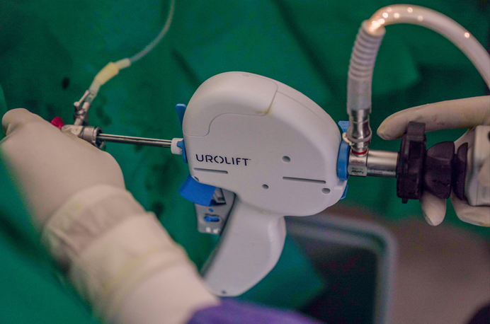 Close-up of a UroLift delivery device during a procedure