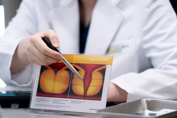 Doctor pointing to the prostate on an anatomical diagram