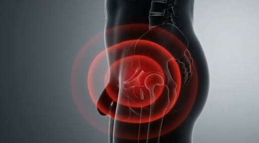 Illustration highlighting pain in the male pelvic region